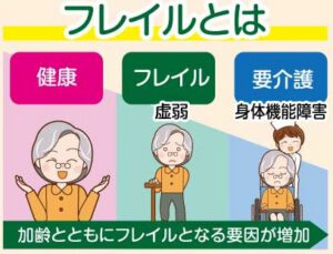フレイル予防けん玉教室